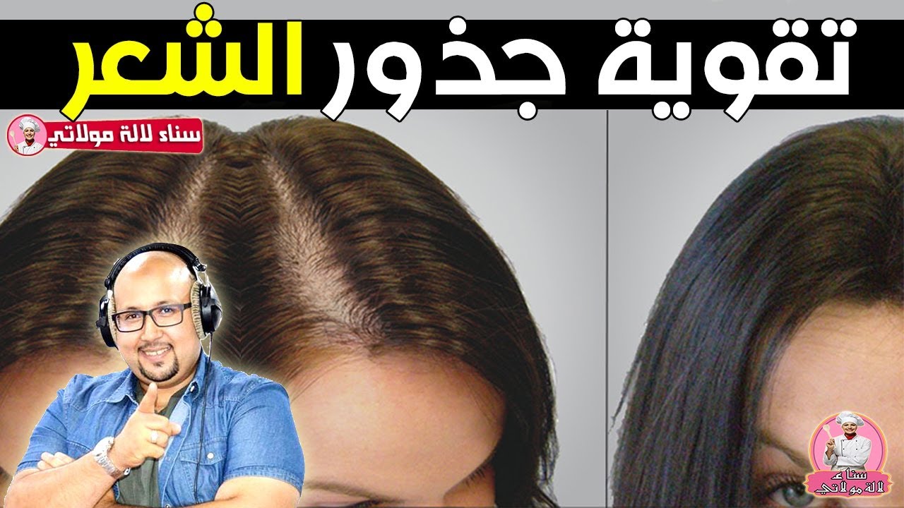 جذور الشعر