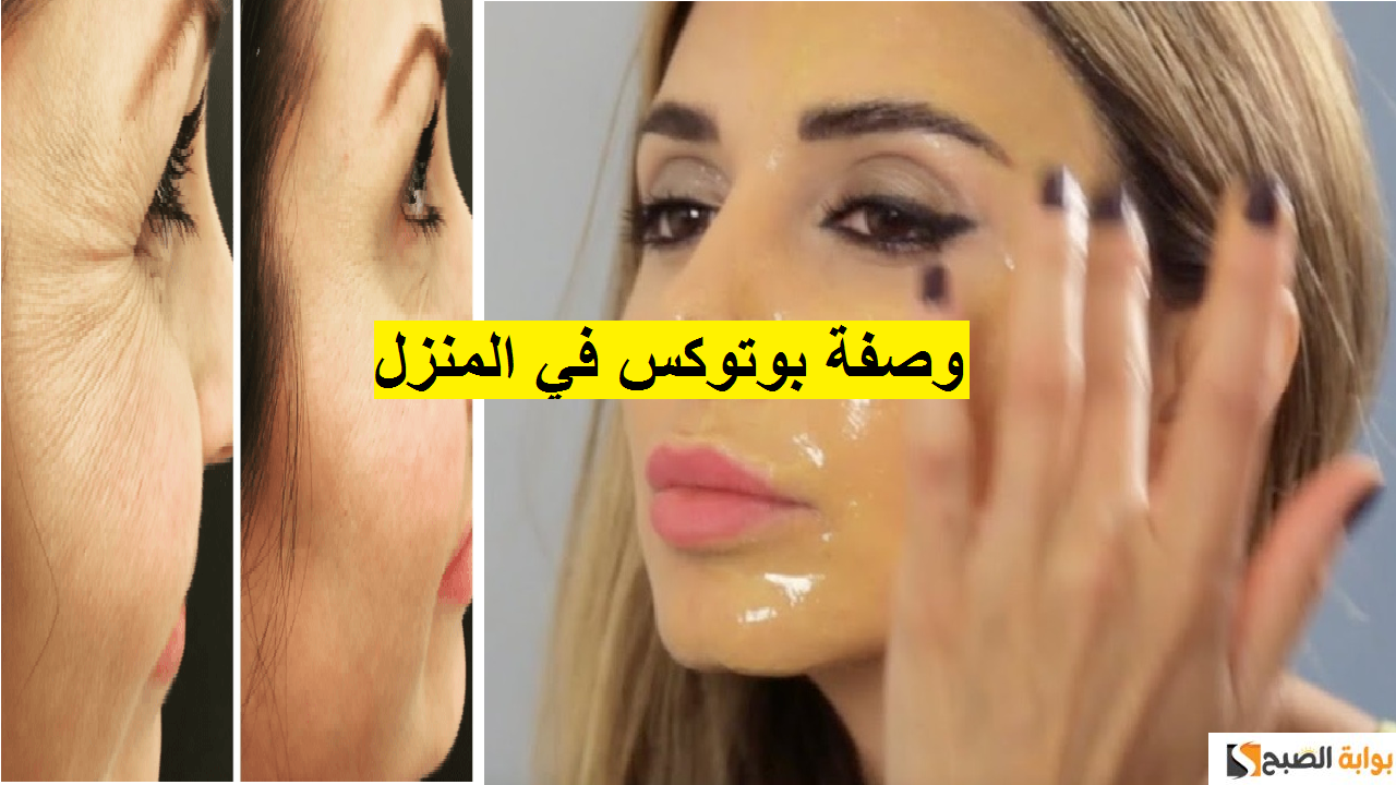 حقن البوتوكس قبل وبعد 202297797