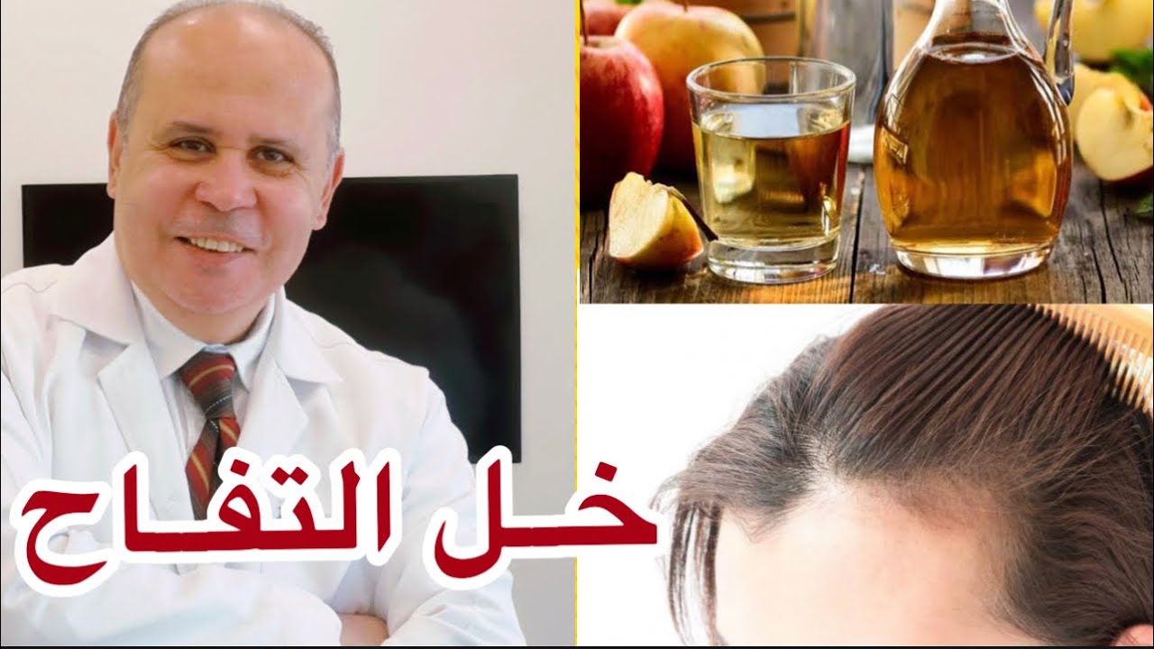 خل التفاح للشعر