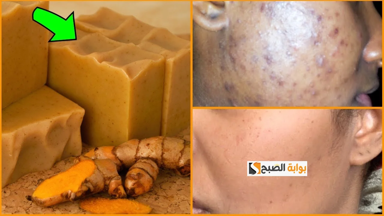 صابونة الكركم للبشرة 1
