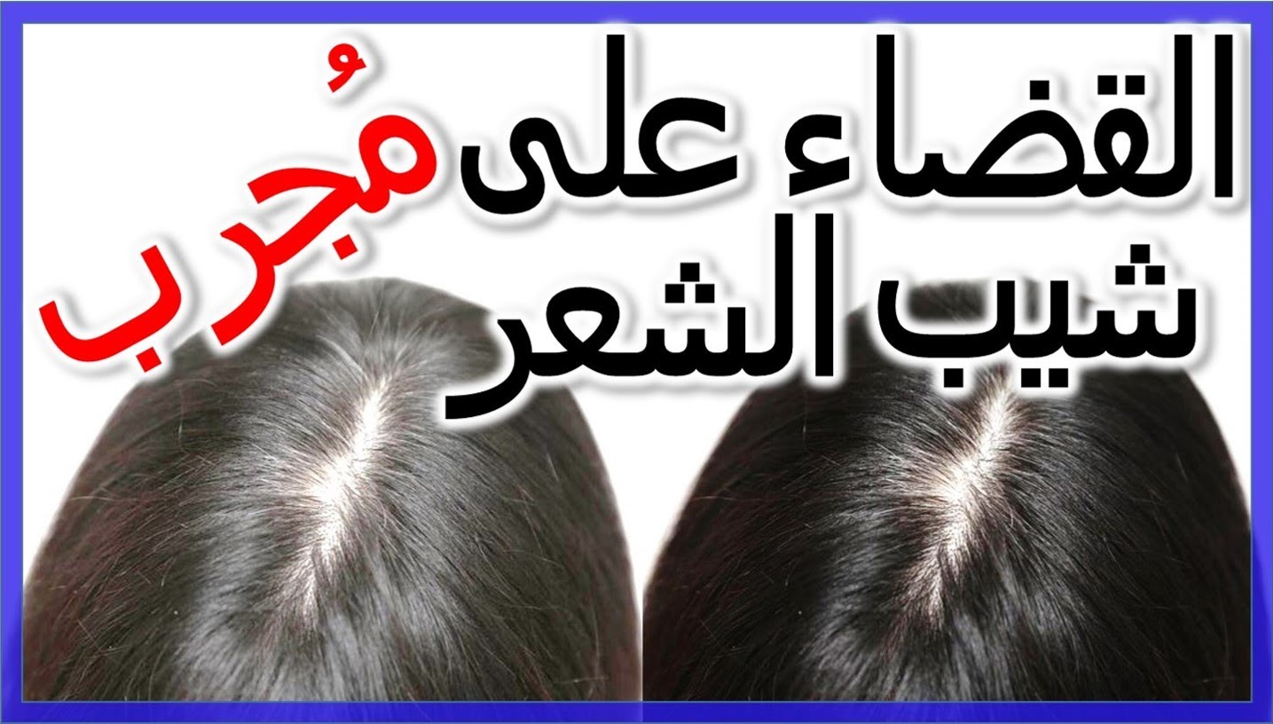 طريقة طبيعية للتخلص من الشيب