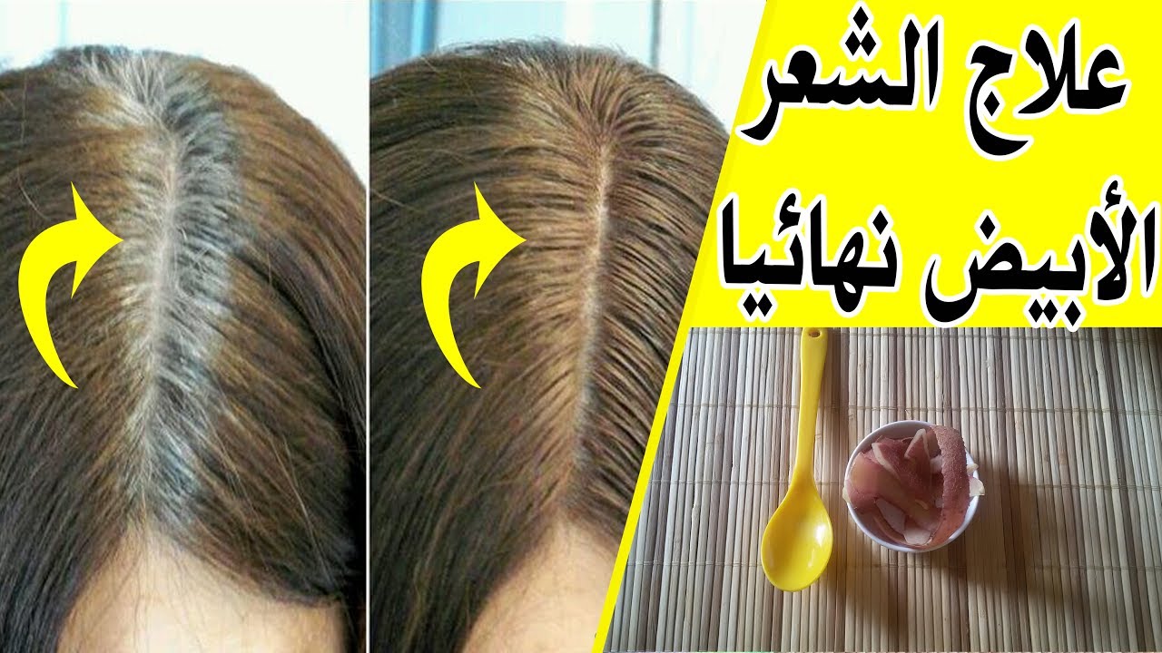 علاج الشعر الأبيض إلى الأبد