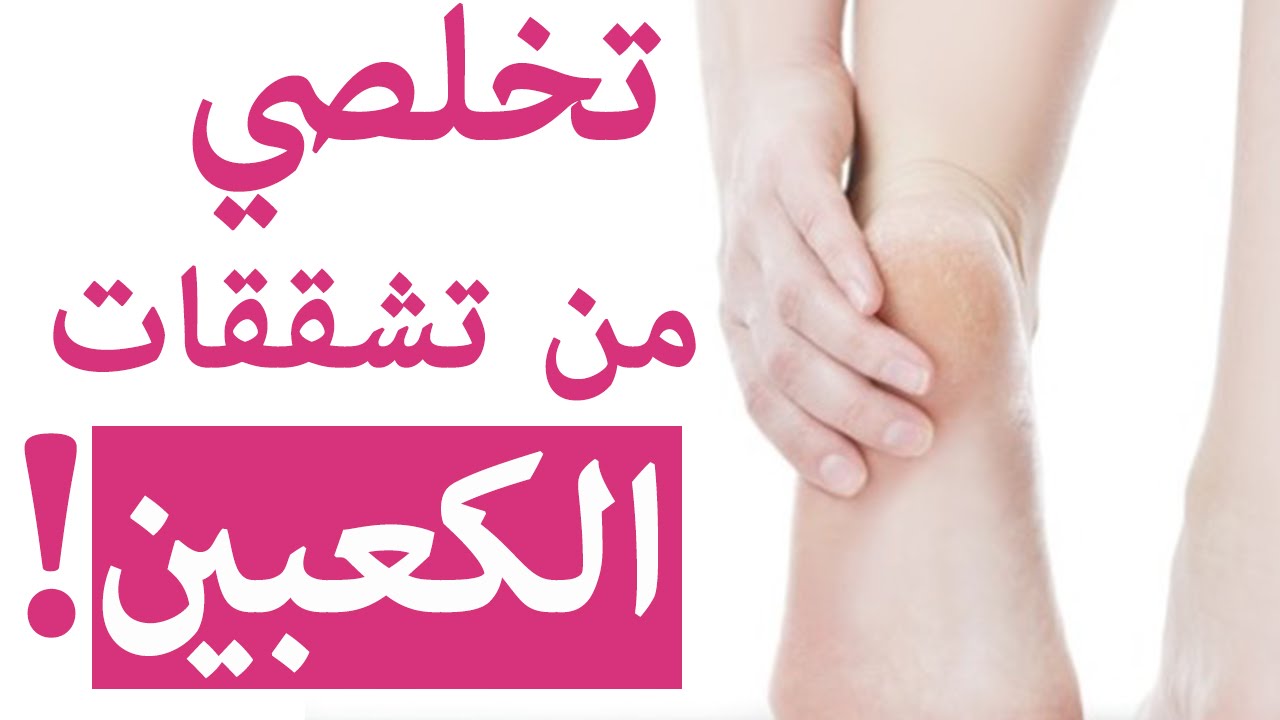 علاج تشقق القدمين