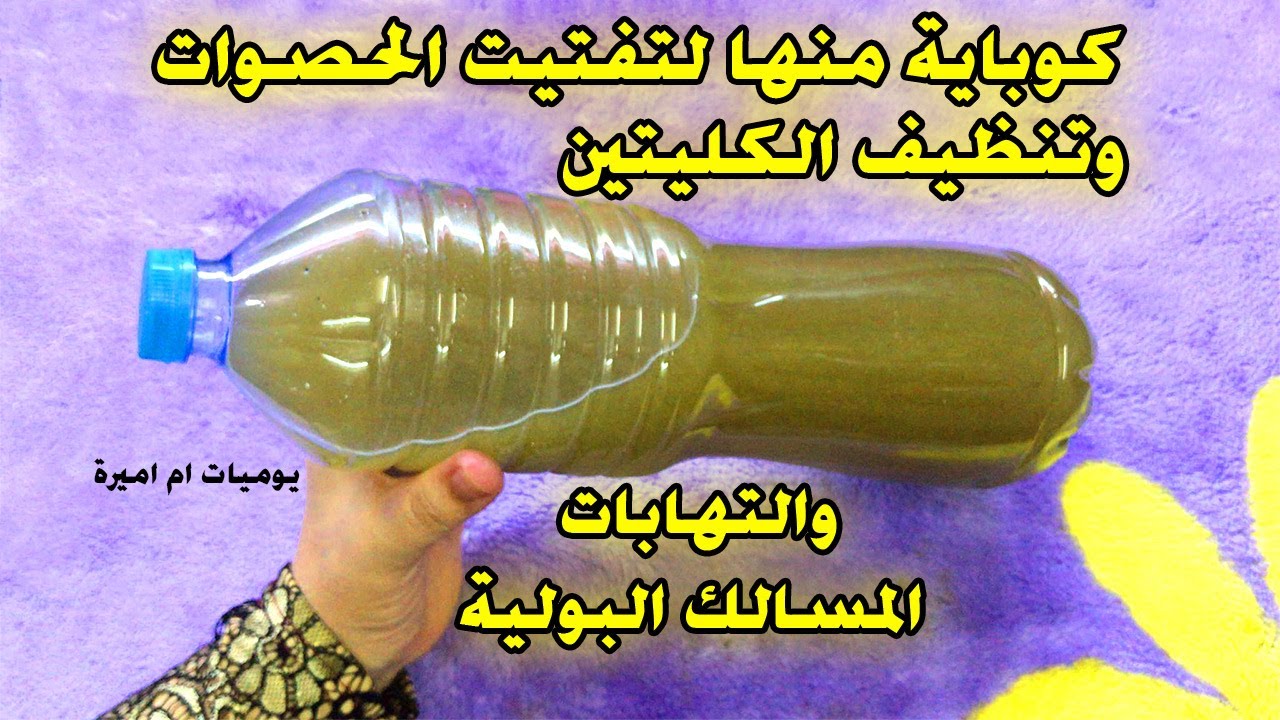 علاج حصوات الكلي