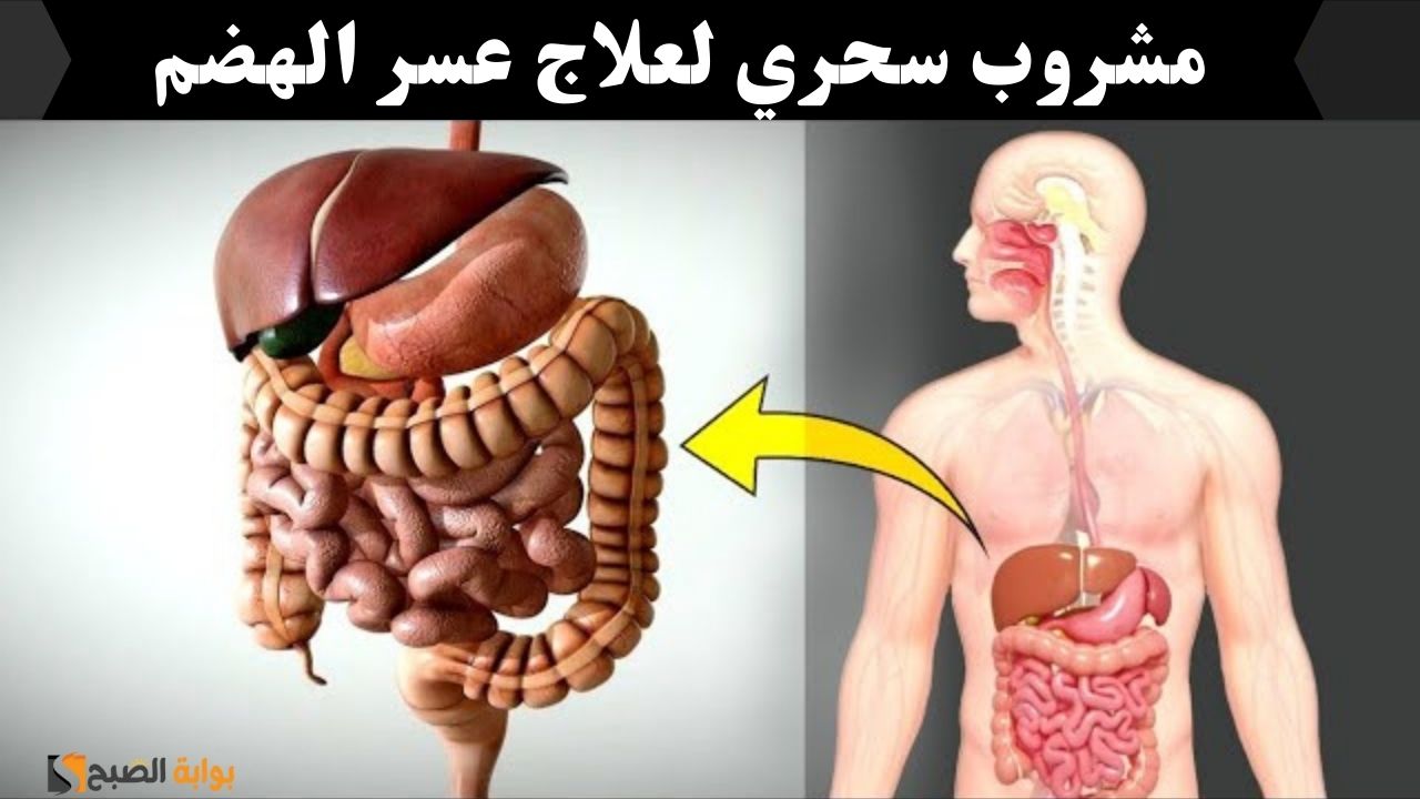 علاج عسر الهضم