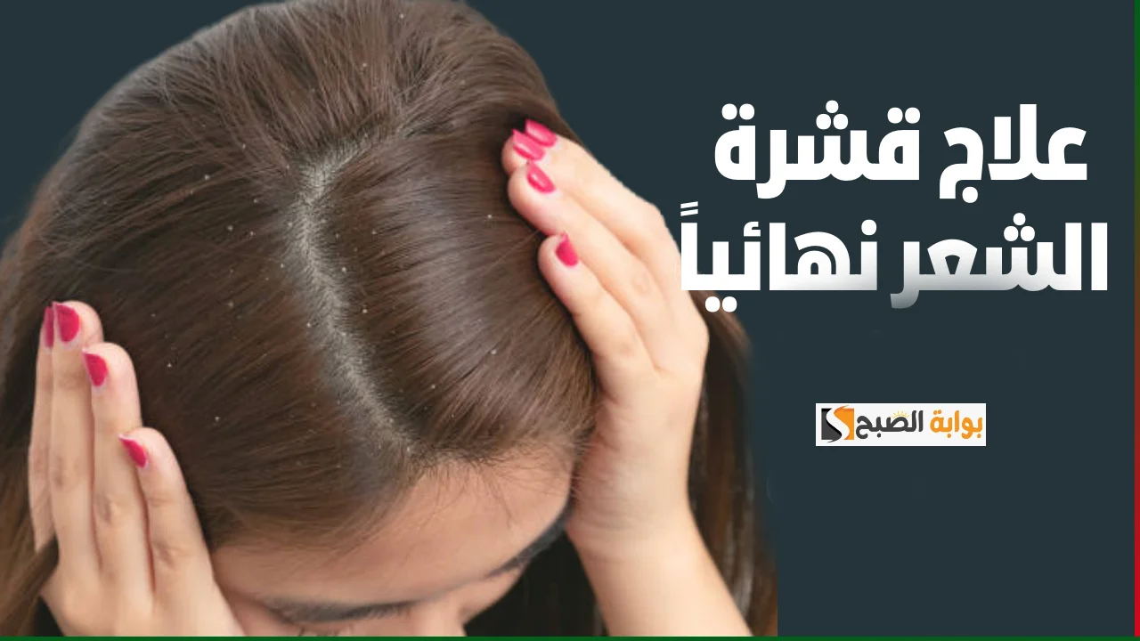 علاج قشرة الشعر