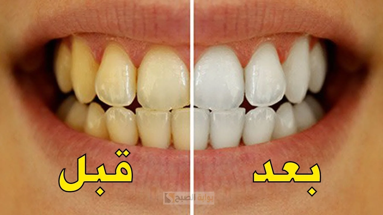 قشر البرتقال لتبييض الأسنان