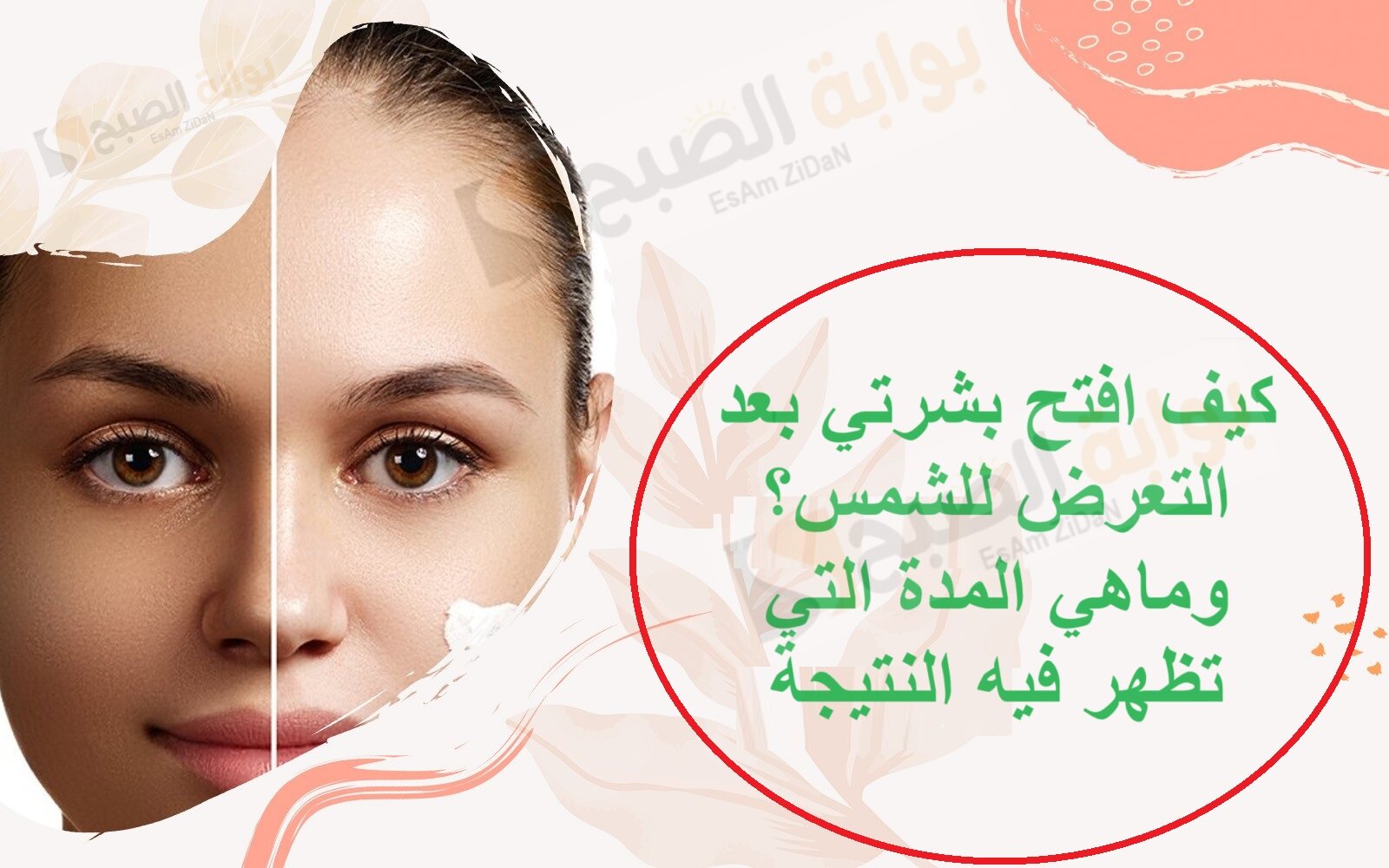 كيف افتح بشرتي بعد التعرض للشمس؟ وماهي المدة التي تظهر فيه النتيجة