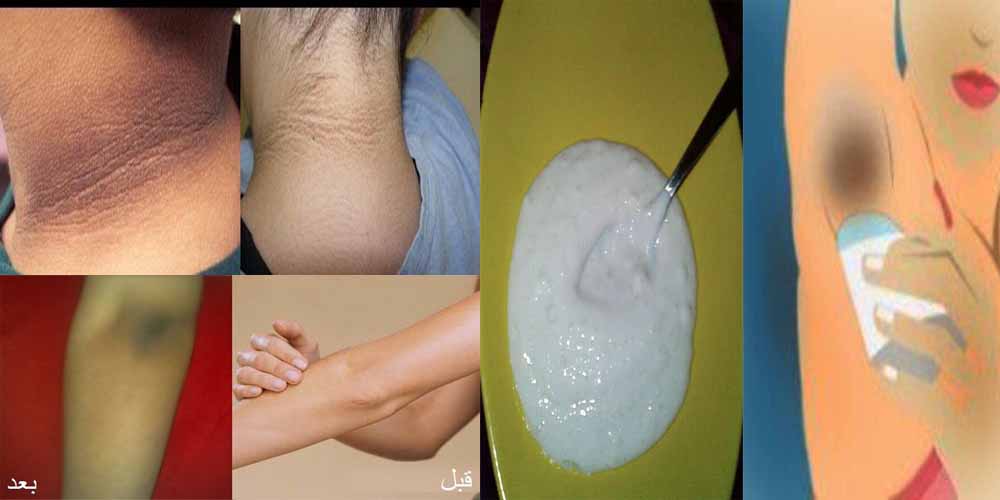 كيفية تبييض المناطق الحساسة بالليمون والنشا 1 1