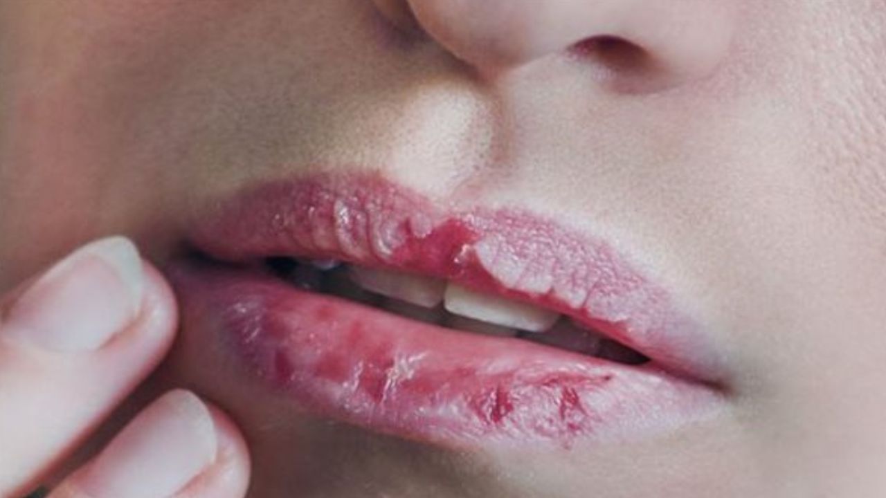 ماسك للشفايف بالسكر