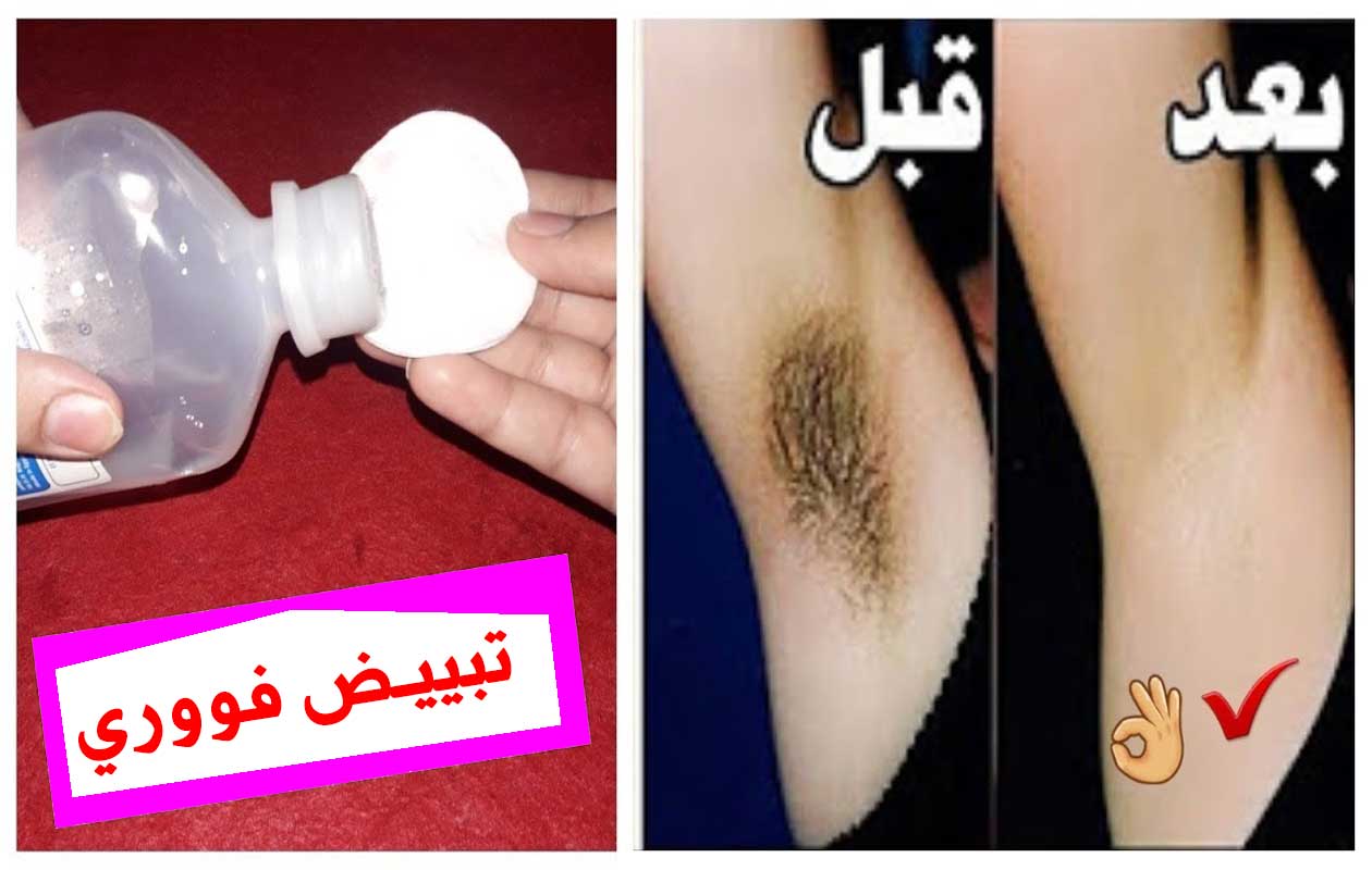 مسحة واحدة تخلصك من شعر العانة والابطين والوجه