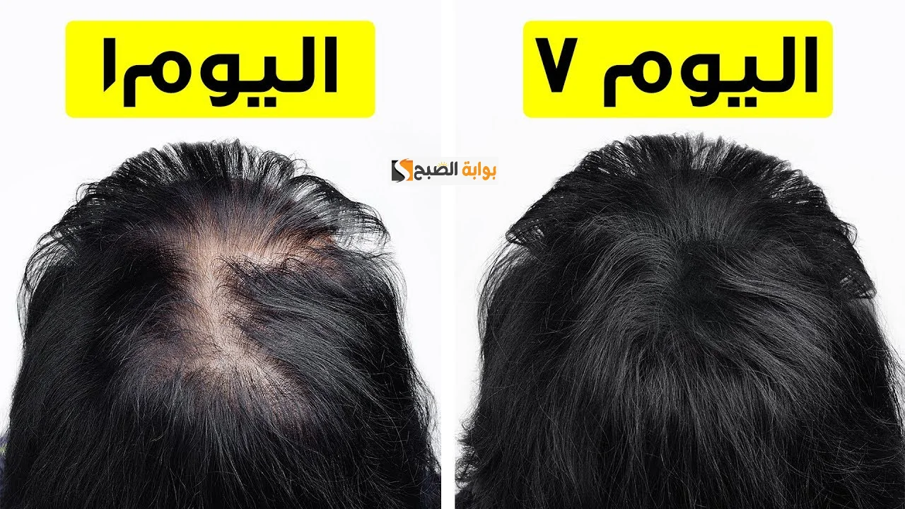 وصفة الروزماري والقرنفل لشعر خيالي