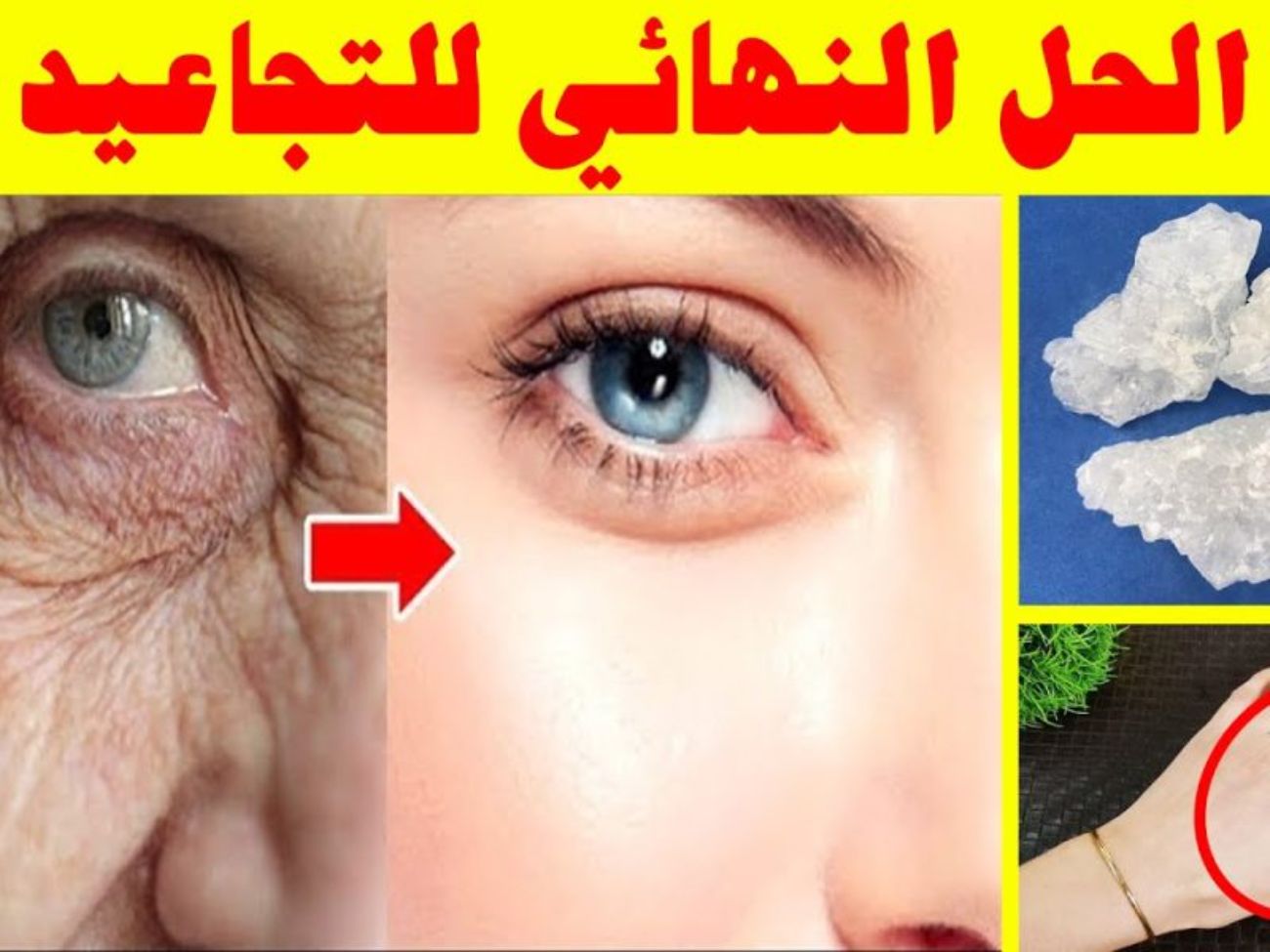 وصفة سحرية لتقليل التجاعيد يمنحك بشرة صحية مرطبة من غير حبوب