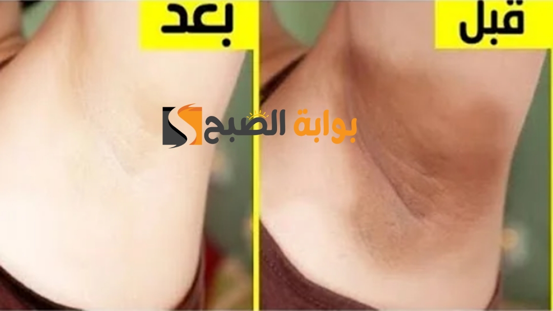 وصفة لتبييض المناطق الحساسة من اول استعمال