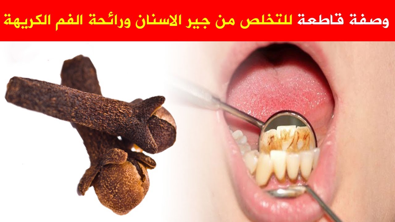 وصفات للتخلص من رائحة الفم الكريهة 