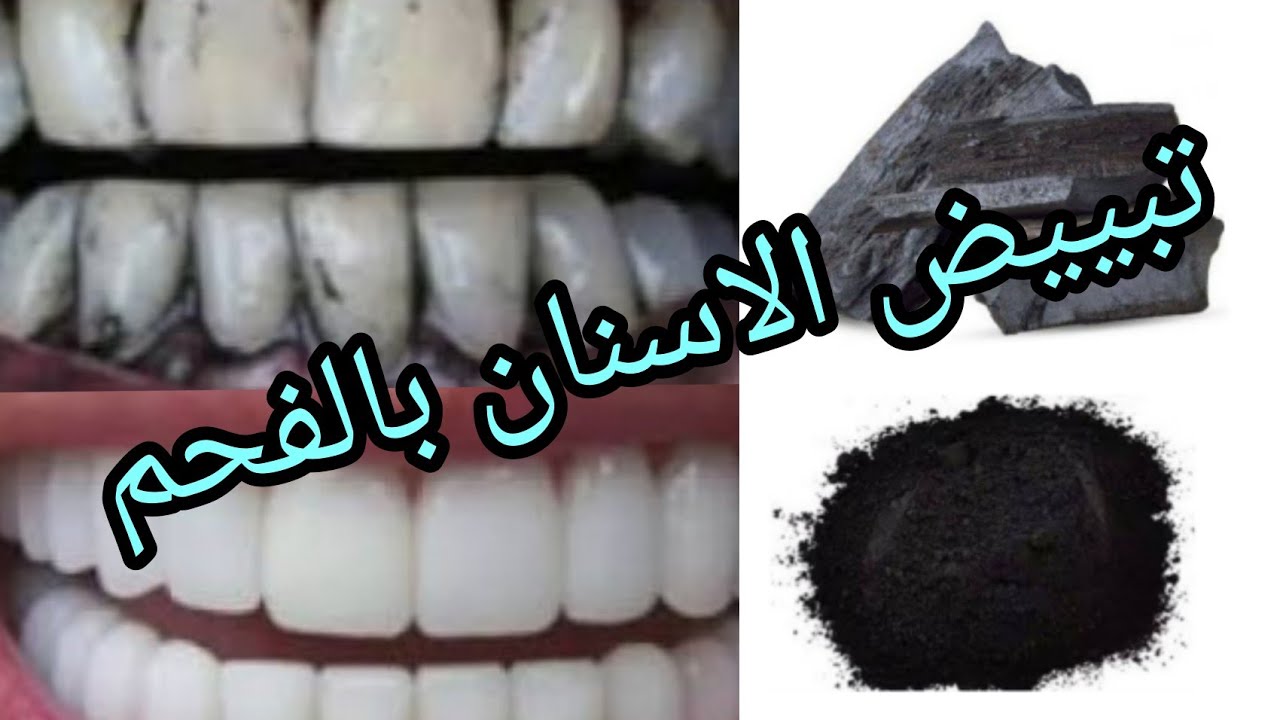 تبييض الاسنان باستخدام الفحم المنشط