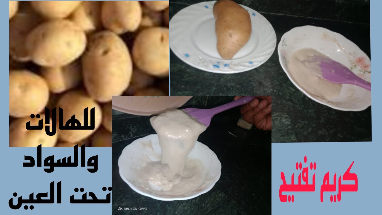 ماسك البطاطس لإزالة الهالات السوداء تحت العين
