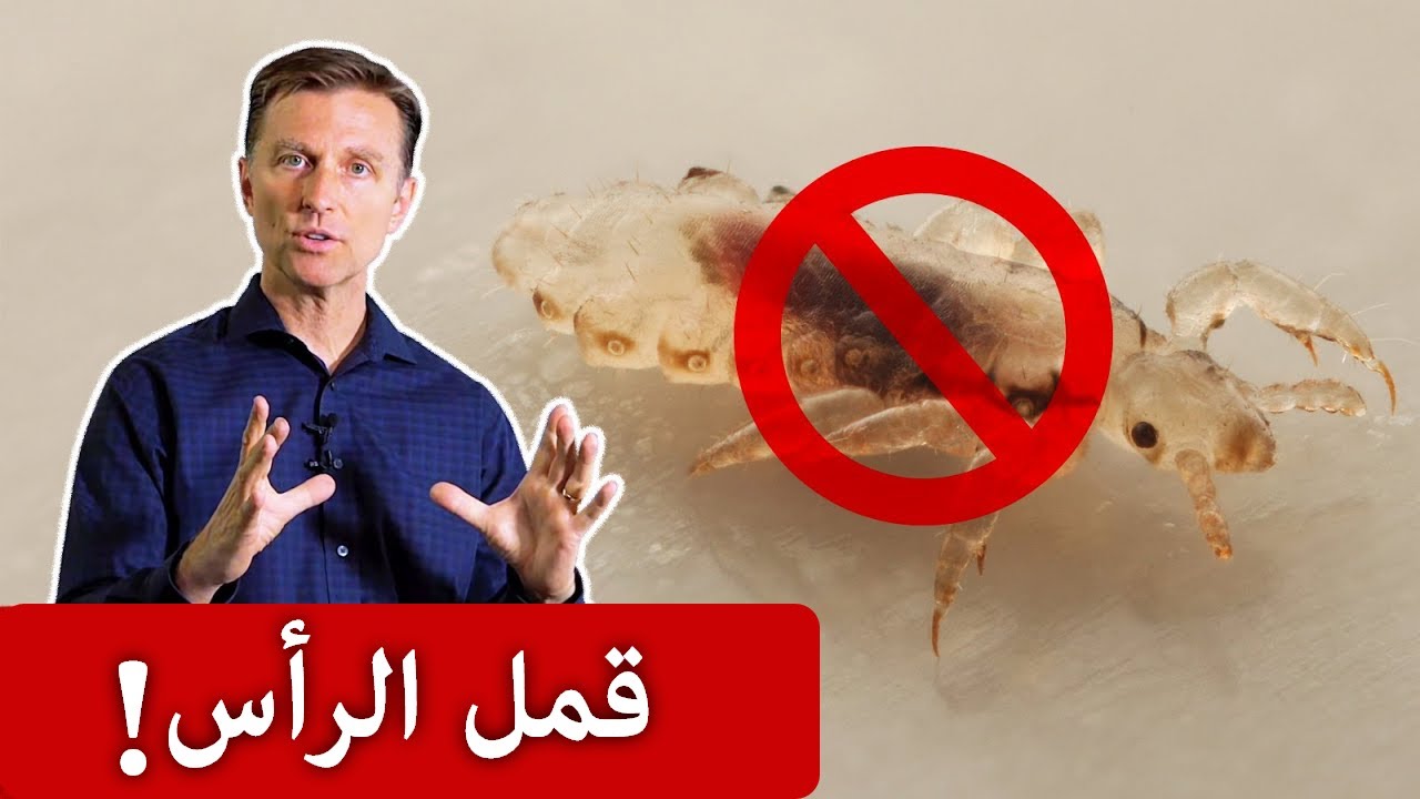 أقوى وصفة للتخلص من حشرات الشعر