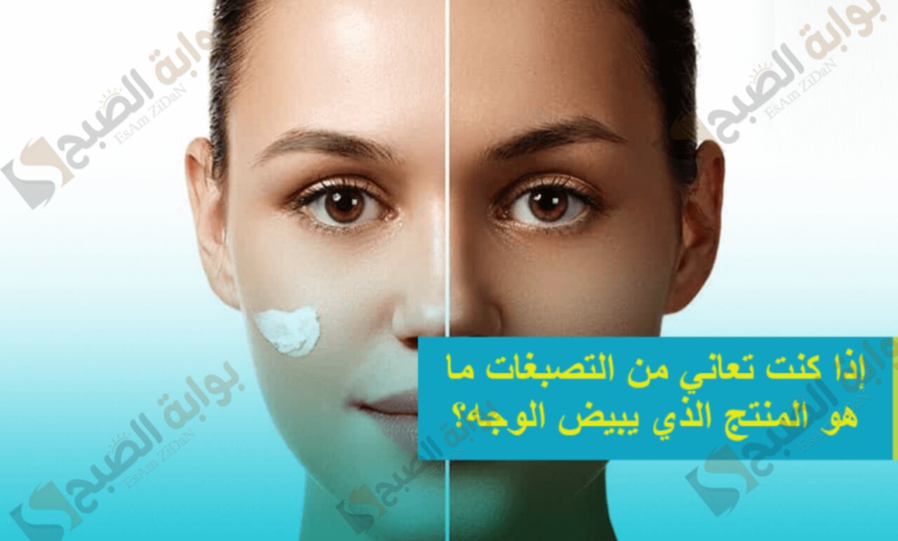 إذا كنت تعاني من التصبغات ما هو المنتج الذي يبيض الوجه؟