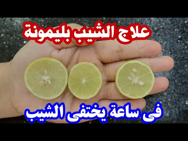 القضاء على الشعر الأبيض بالليمون