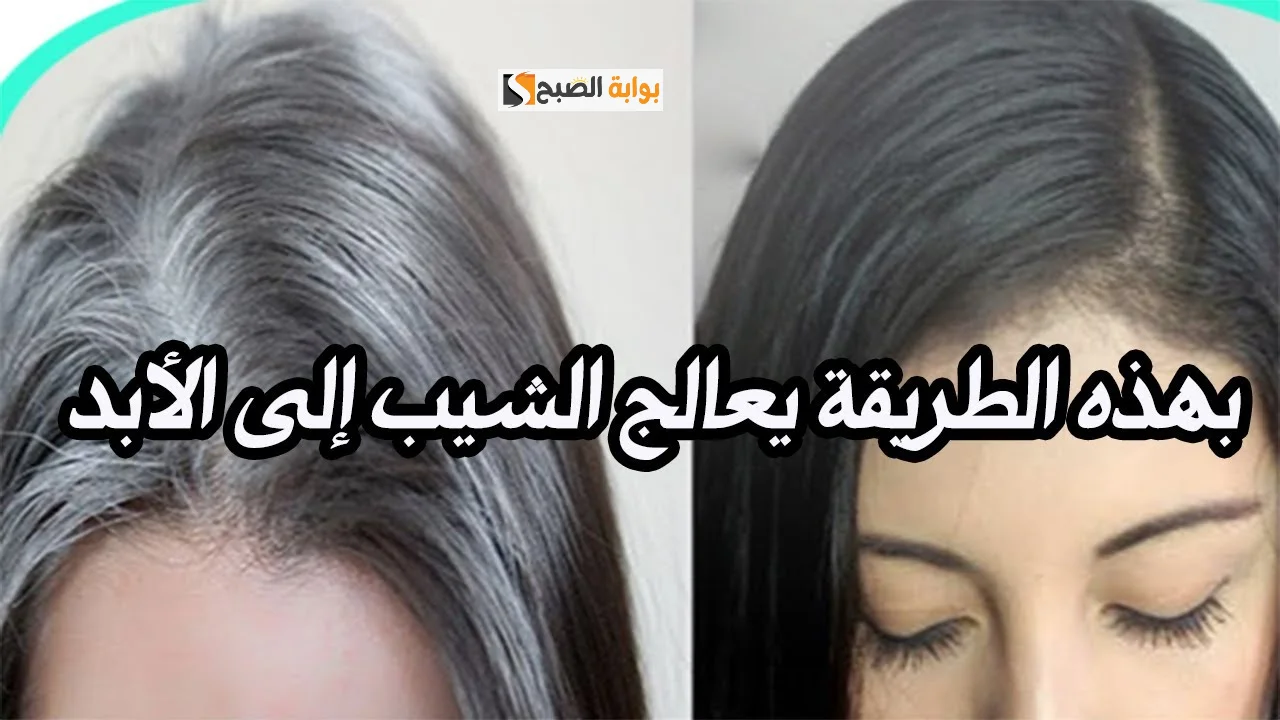 القضاء على الشعر الأبيض