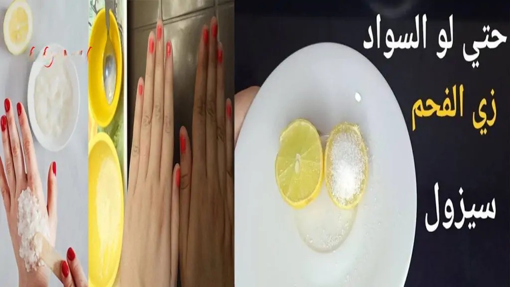 تبييض المناطق الحساسة 1024x576 1