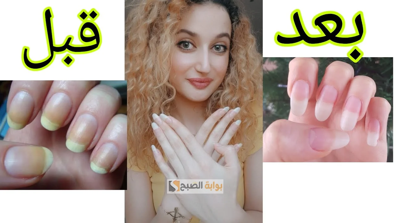 تفتيح الأظافر