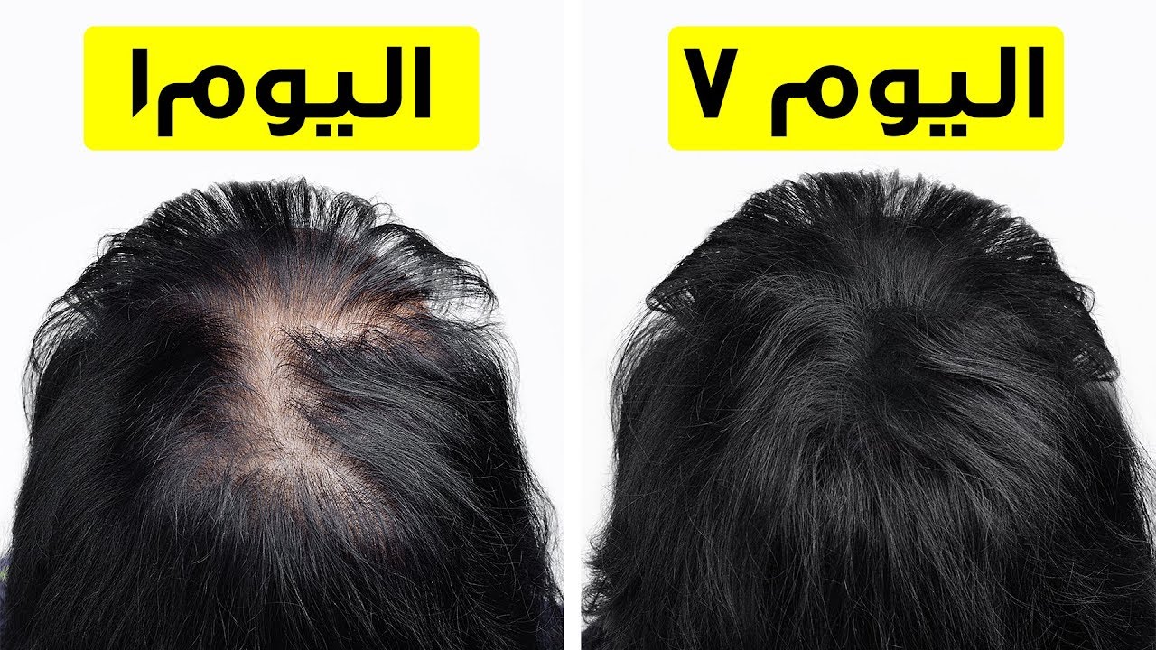 تكثيف الشعر الخفيف