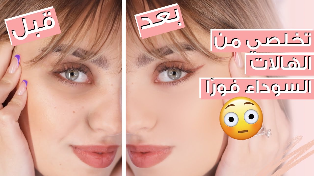 خلطات طبيعية للتخلص من الهالات والتجاعيد