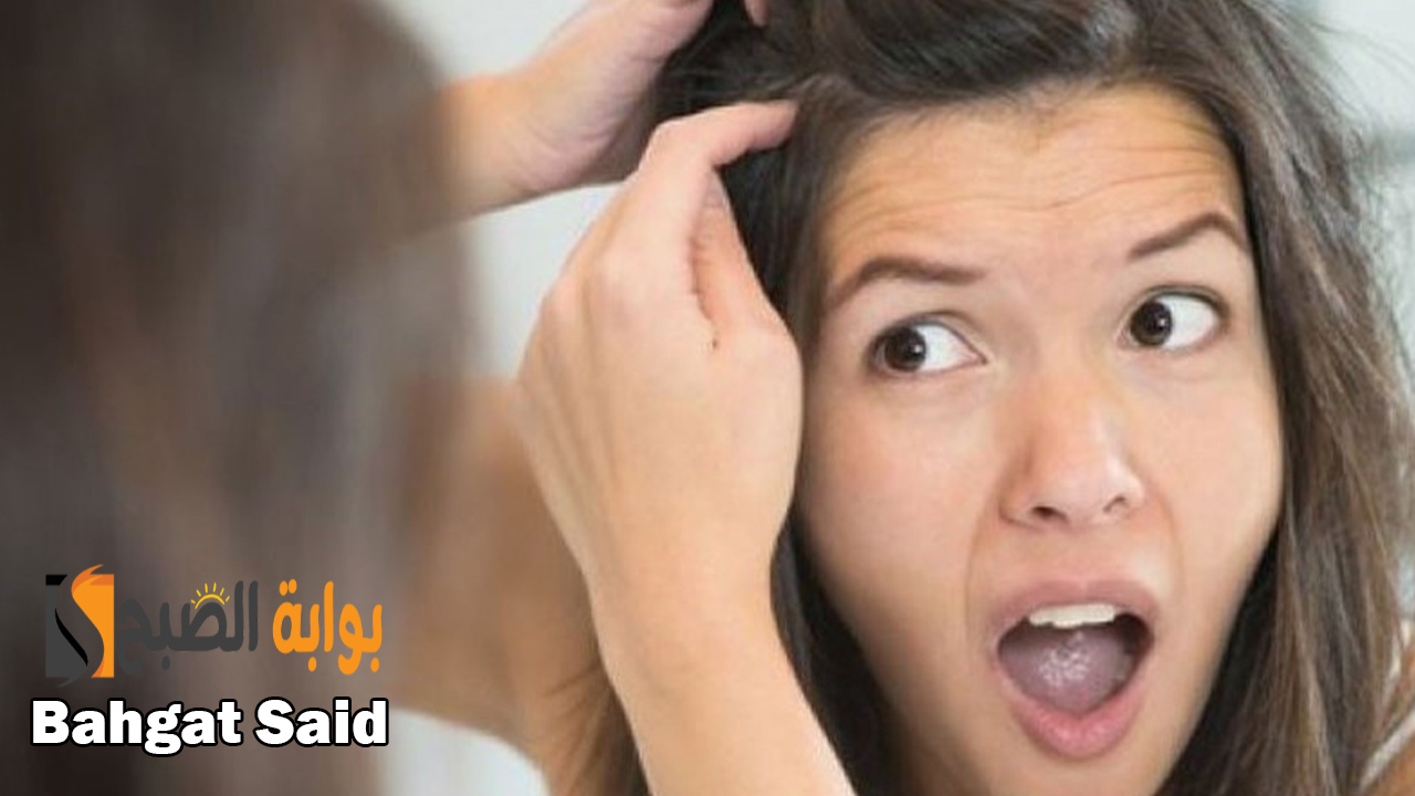 خلطات لمنع ظهور الشعر الأبيض