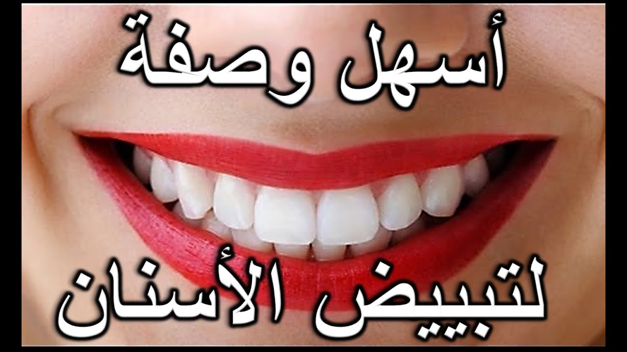 خلطة تبييض الاسنان بالقرنفل 
