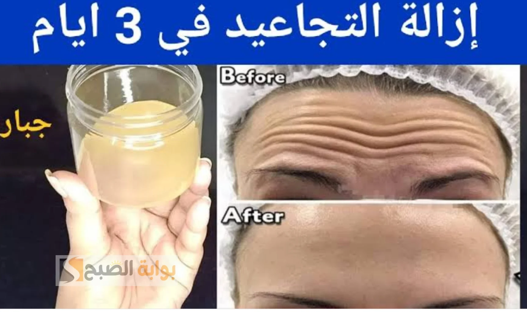 خلطة-لإزالة-التجاعيد
