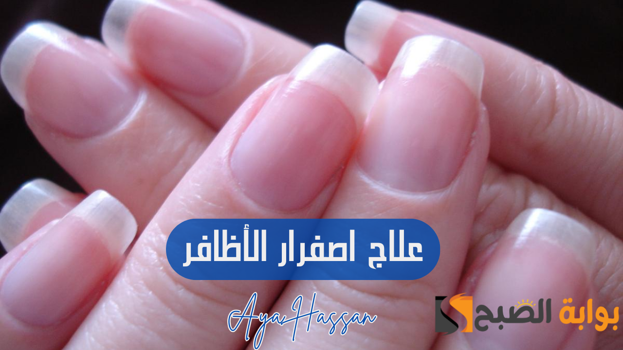 طرق علاج إصفرار الأظافر
