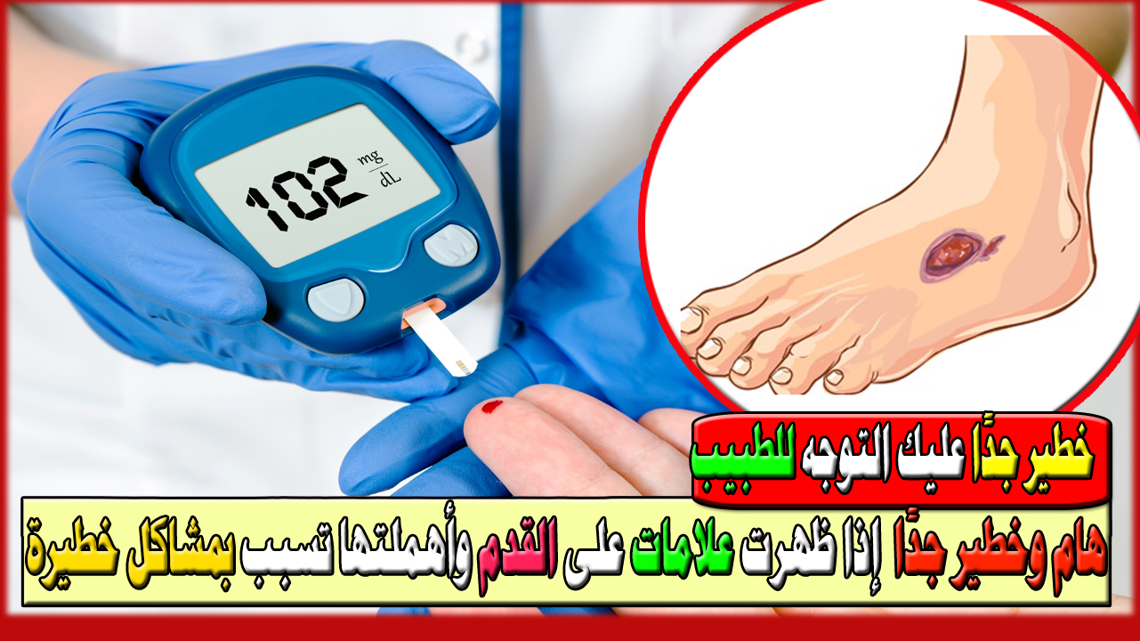 علامات قد تشير إلى إصابتك بمرض السكري