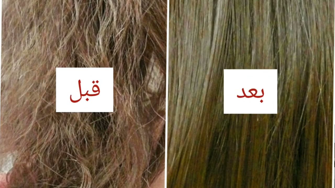 وصفات طبيعية لعلاج هيشان الشعر