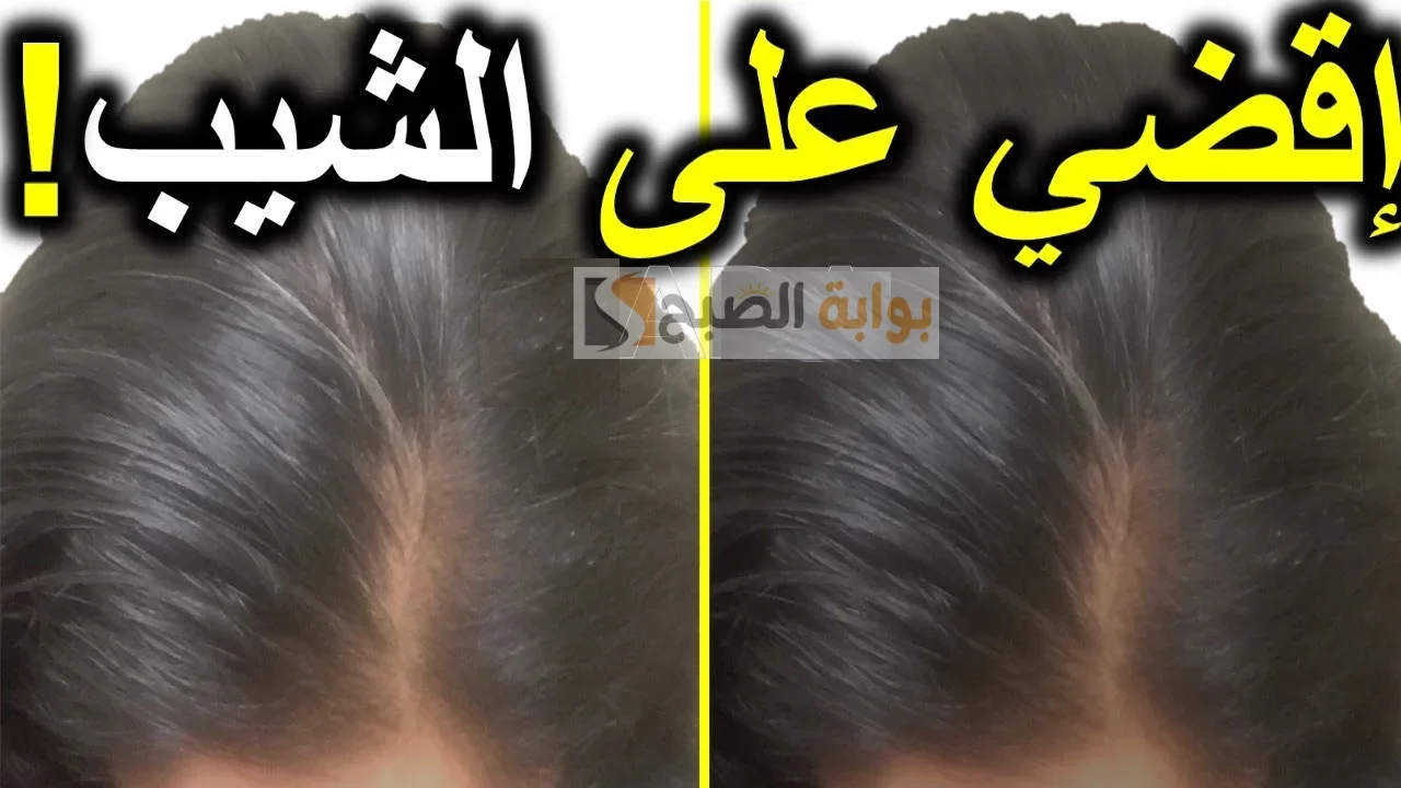 وصفة القرنفل للتخلص من الشعر الأبيض