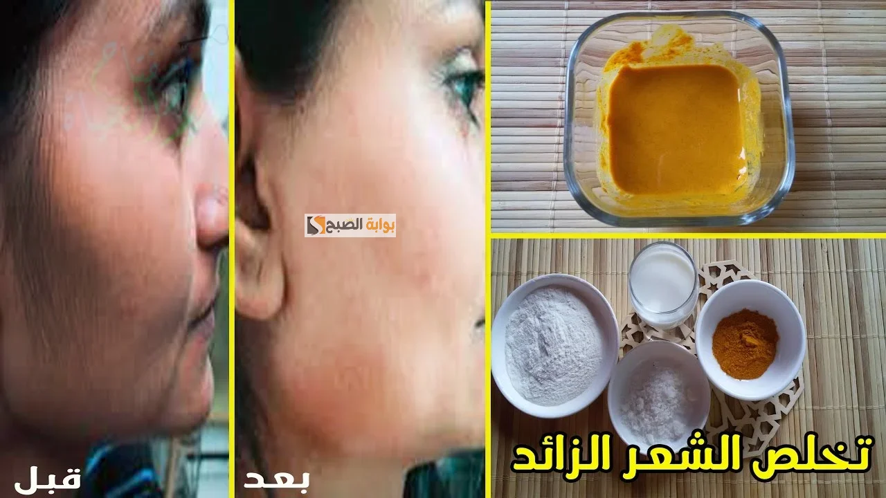 وصفة الليمون والنشا لإزالة الشعر