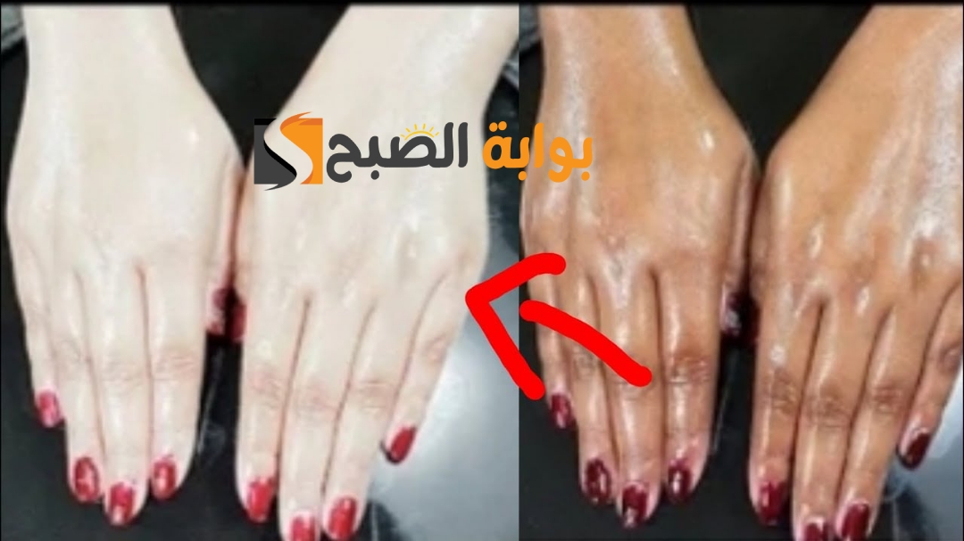 وصفة تبييض اليدين في 5 دقائق