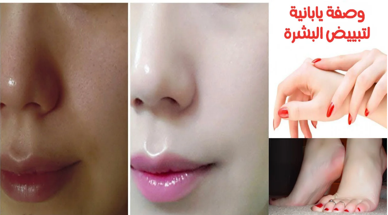 وصفة يابانية لتفتيح البشرة والتخلص من البقع الداكنة