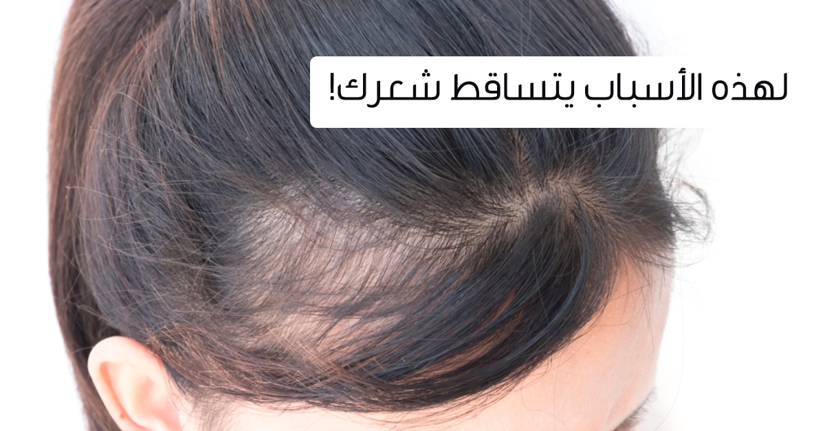 أسباب تساقط الشعر بكثرة عند النساء 1