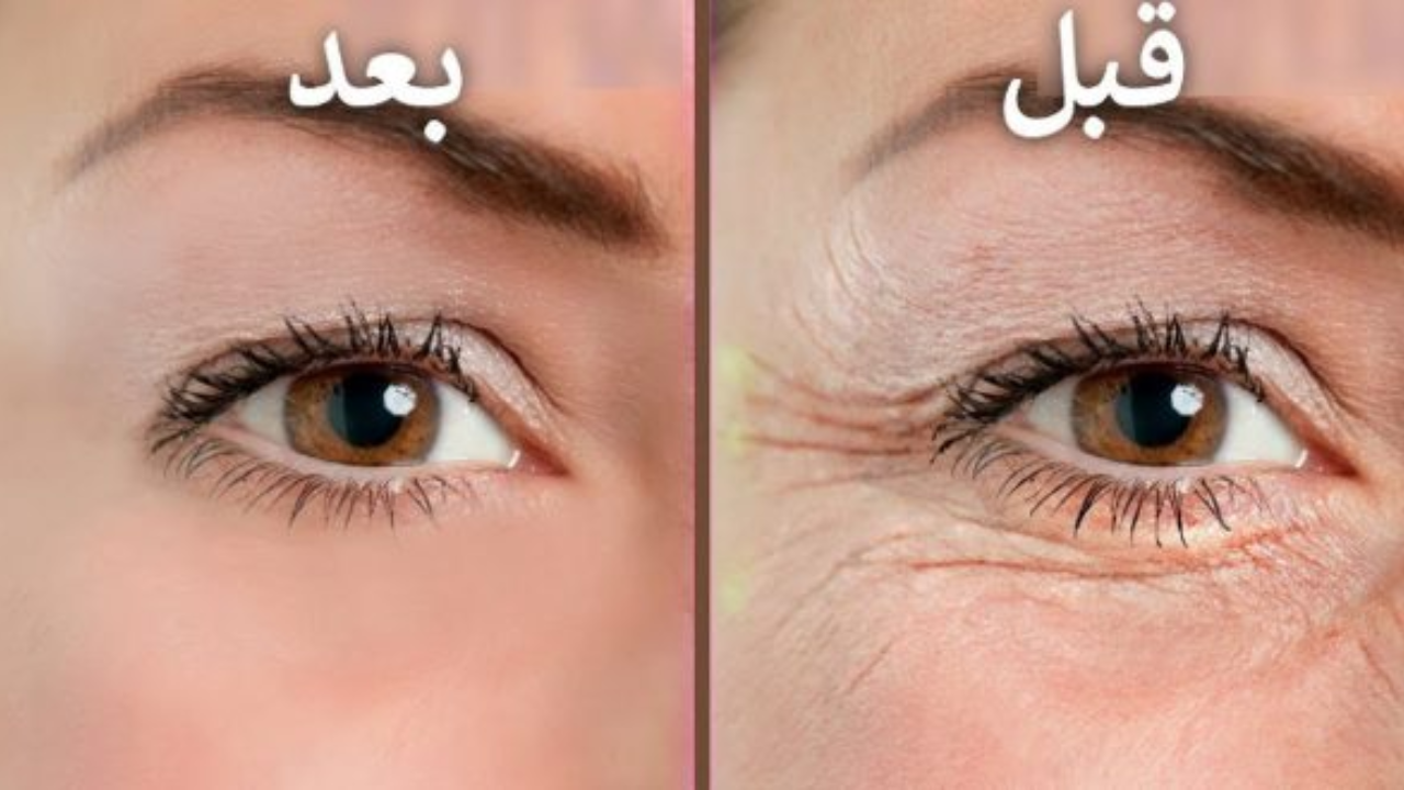 أفضل وصفة للتجاعيد