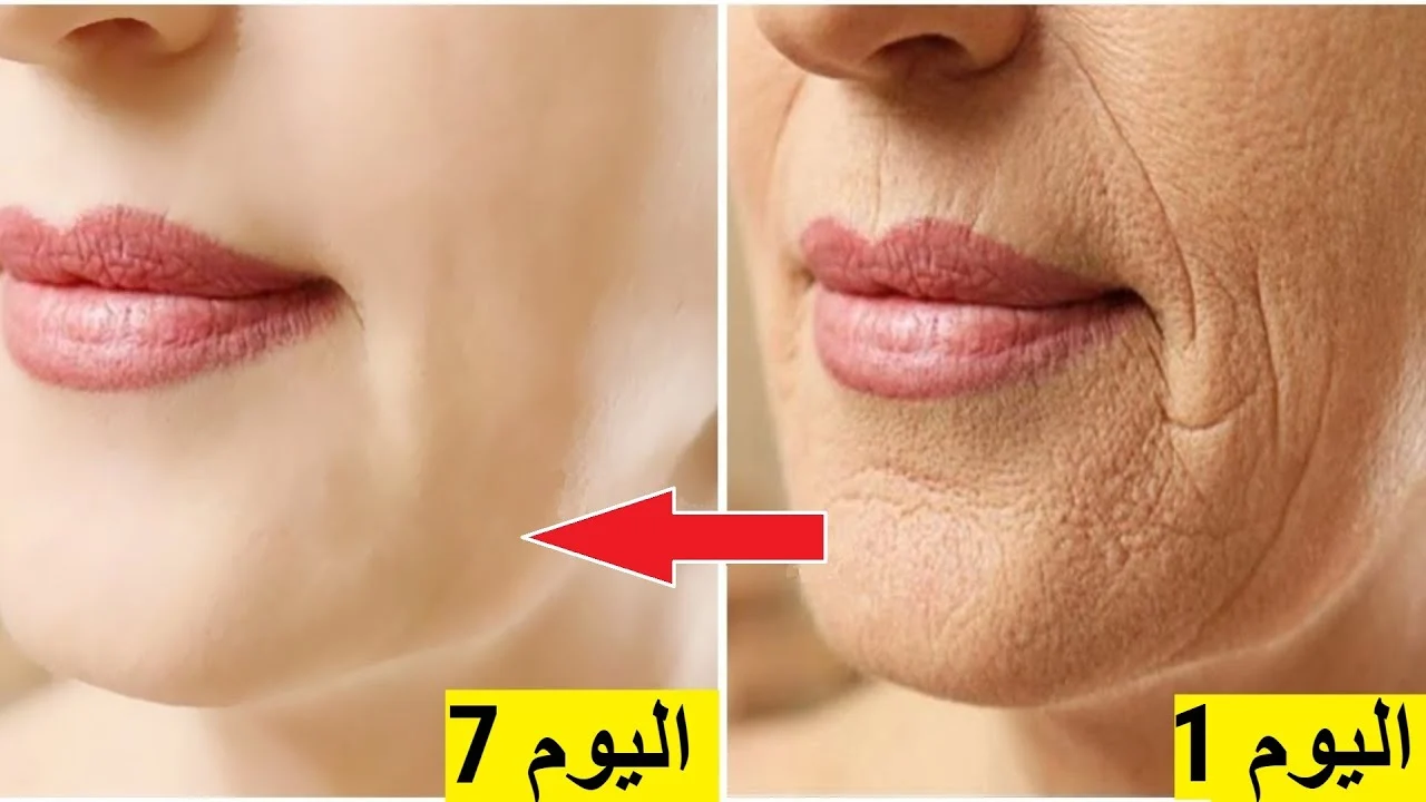 البوتكس السحري النشا والخميرة يخلصك من التجاعيد ويفتح البشرة في دقائق