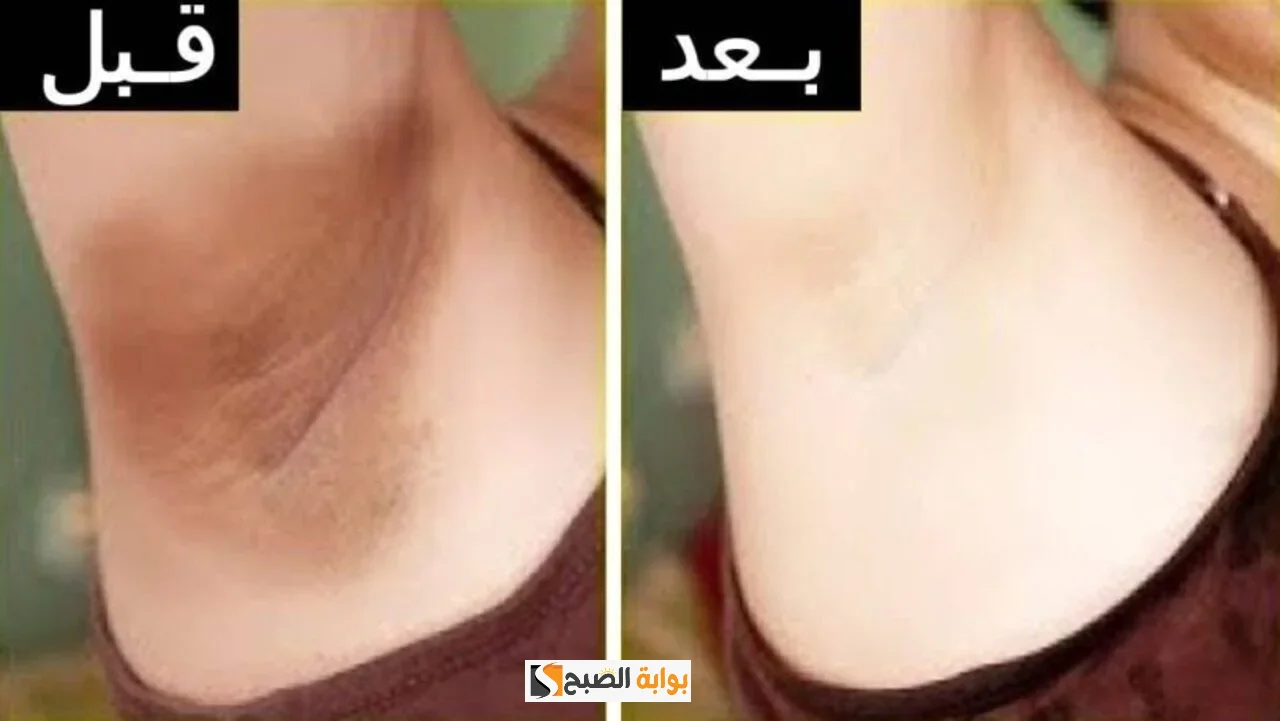 تفتيح المناطق الحساسة