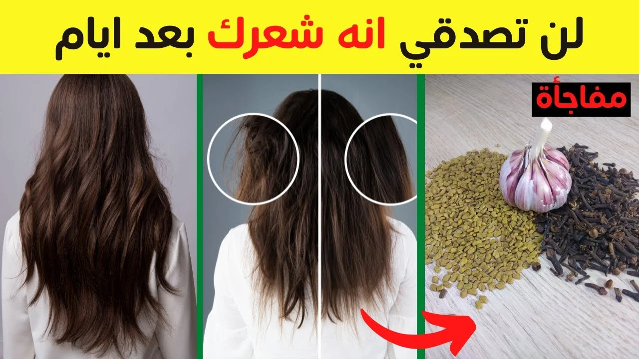 تطويل وتكثيف الشعر وابنات الفراغات