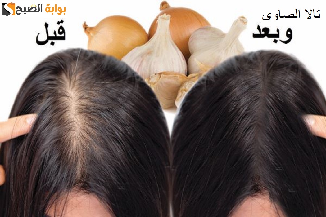 طريقة عمل زيت البصل والثوم لملء الفراغات وتطويل الشعر في وقت قصير