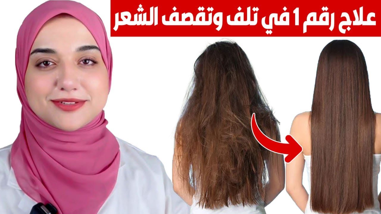طريقة ماسكات الألوفيرا لإطلاله ساحرة وشعر صحي