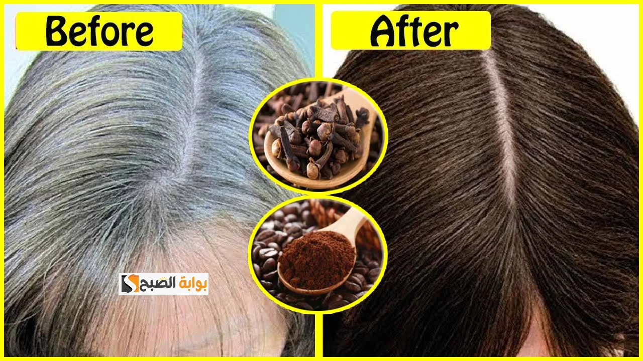 _ماسك البطاطس والقهوة للتخلص من الشيب نهائيا