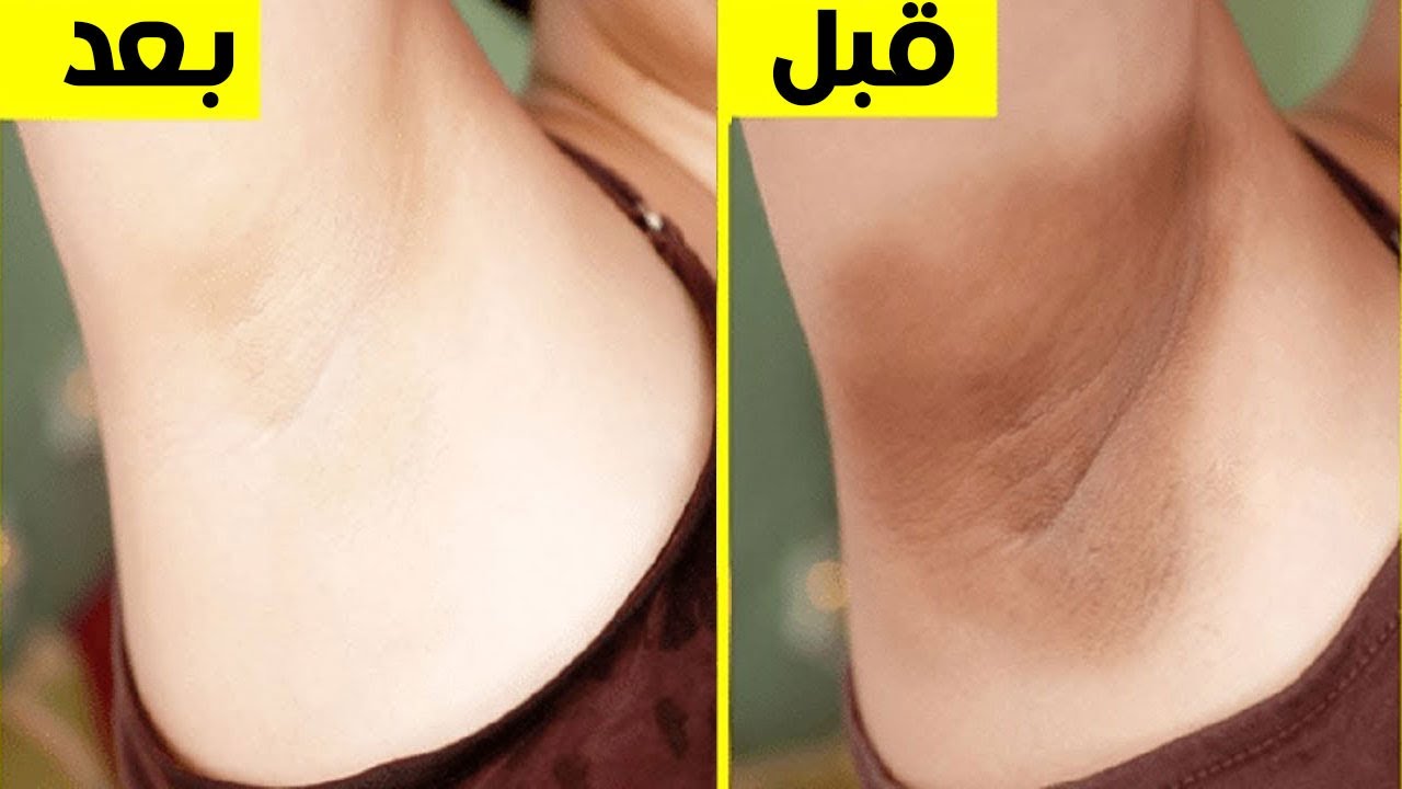 وصفات طبيعية لتبيط الابط