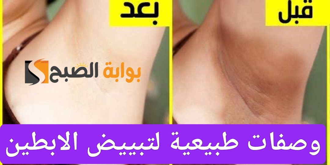 تبييض الابطين