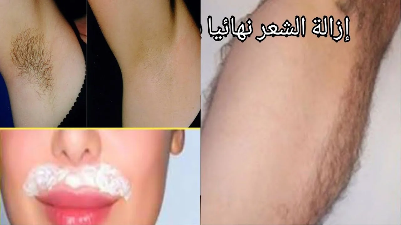 اقوي من الليزر السويت لازاله شعر الجسم